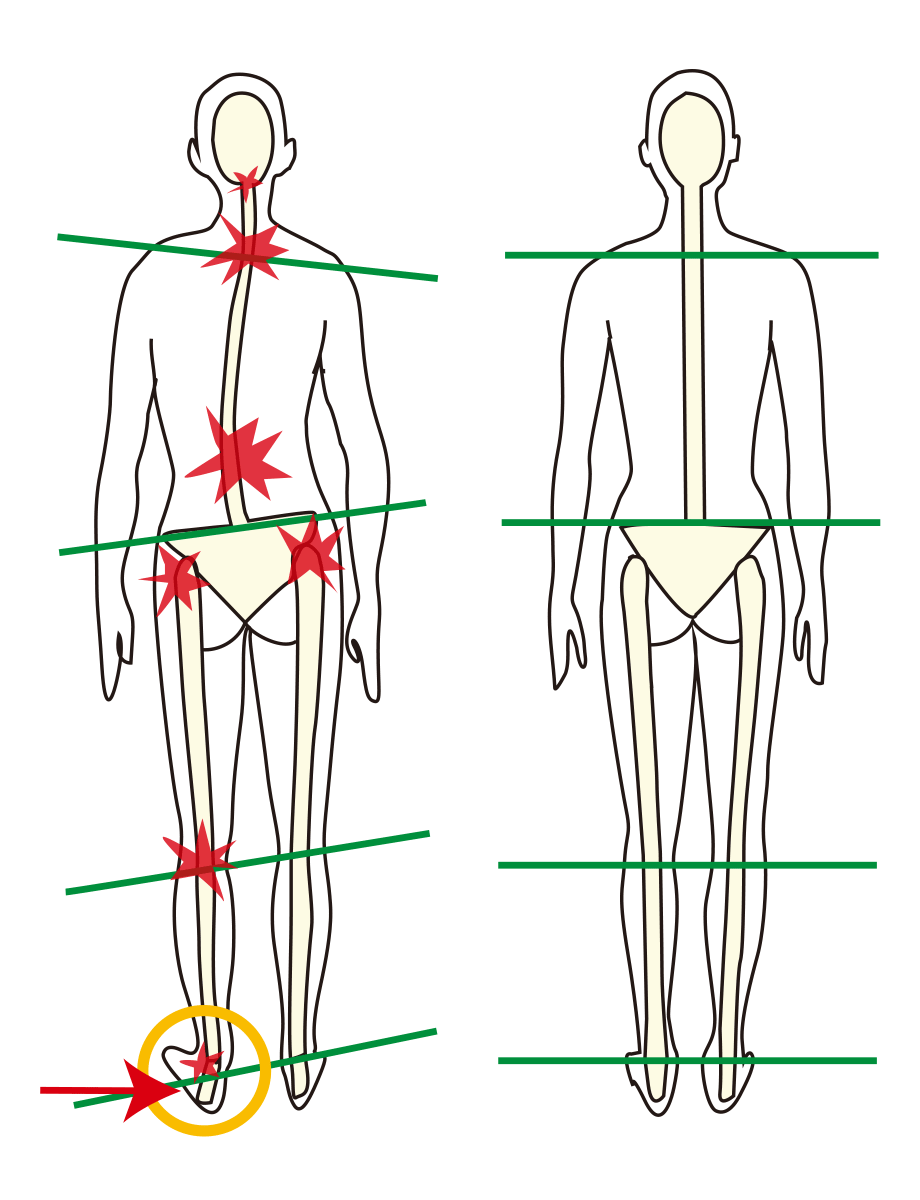 カスタム・インソール
